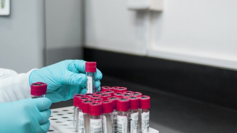 ONZ alarmuje: Liczba osób zakażonych HIV na świecie to aż 39 milionów